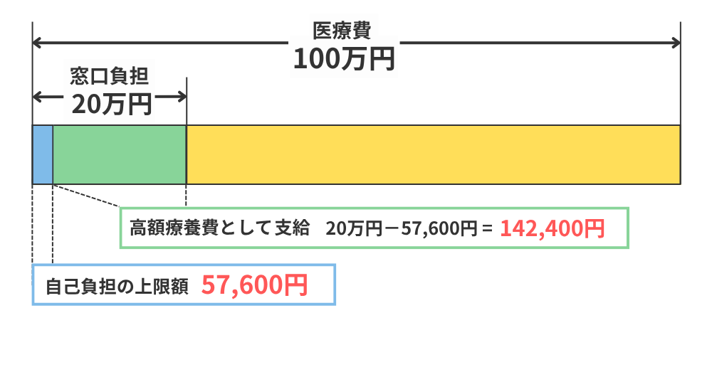 生命保険,高額療養費制度,70歳以上2割負担の場合