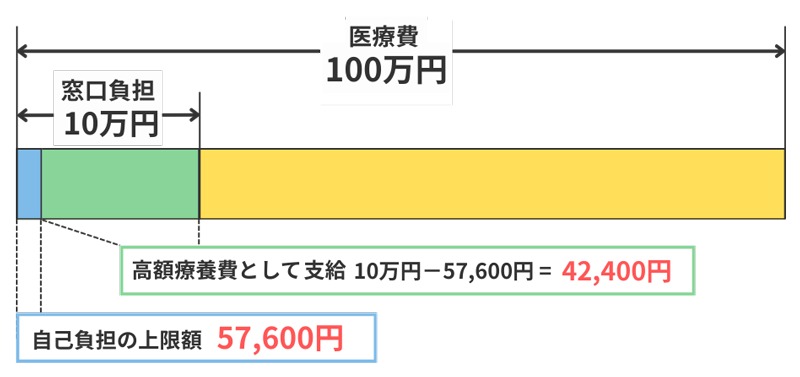 高額療養費のイメージ
１割負担
